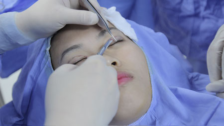“Lắng nghe” chuyên gia chia sẻ về kỹ thuật bấm mí Hàn Quốc Dove Eyes4
