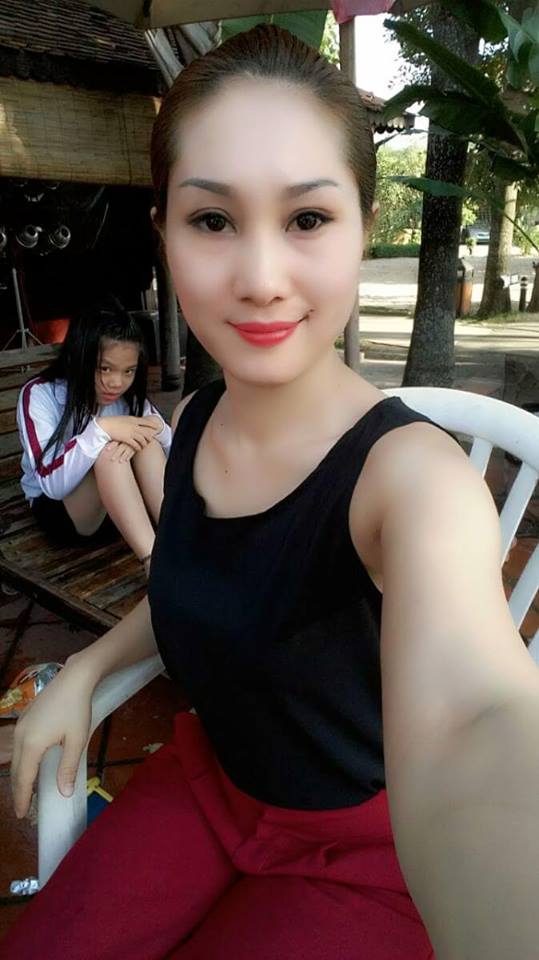 Phẫu thuật cắt mí sụp66788