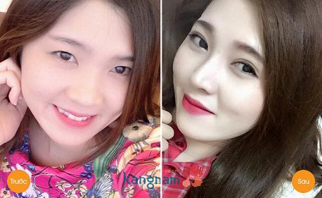 Thế nào là đôi mắt đẹp6