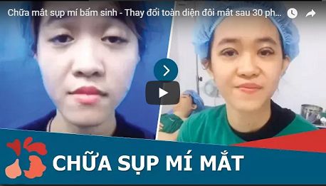 Chữa sụp mí mắt có nguy hiểm không5