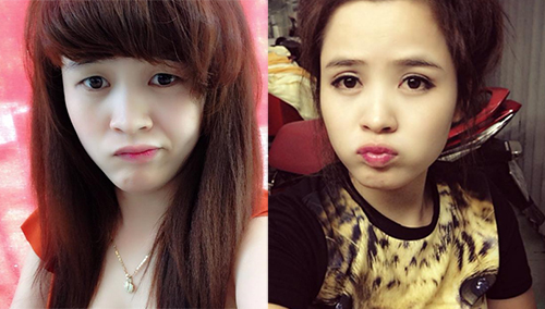 Địa chỉ thẩm mỹ mắt uy tín chuẩn Hàn ngay tại Việt Nam9000