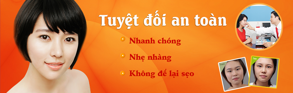 Cắt mí mắt an toàn theo công nghệ Hàn Quốc