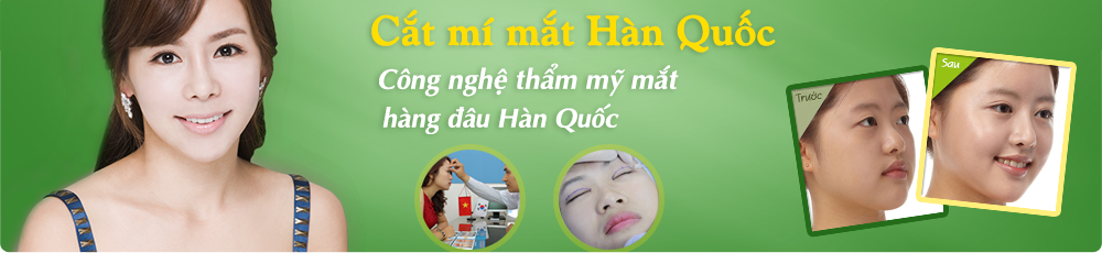 Cắt mí mắt Hàn Quốc công nghệ số 1 Hàn Quốc