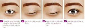Địa chỉ bấm mí Hàn Quốc Dove Eyes đẹp nhất tại Hà Nội?