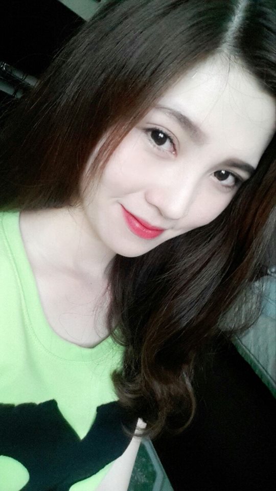 Mắt 2 mí to tròn đã không còn là giấc mơ với Tô Tuyết Trâm 15 Mắt 2 mí to tròn đã không còn là giấc mơ với Tô Tuyết Trâm 14