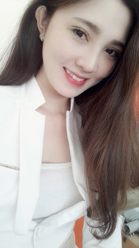 Mắt 2 mí to tròn đã không còn là giấc mơ với Tô Tuyết Trâm 17 Mắt 2 mí to tròn đã không còn là giấc mơ với Tô Tuyết Trâm 16