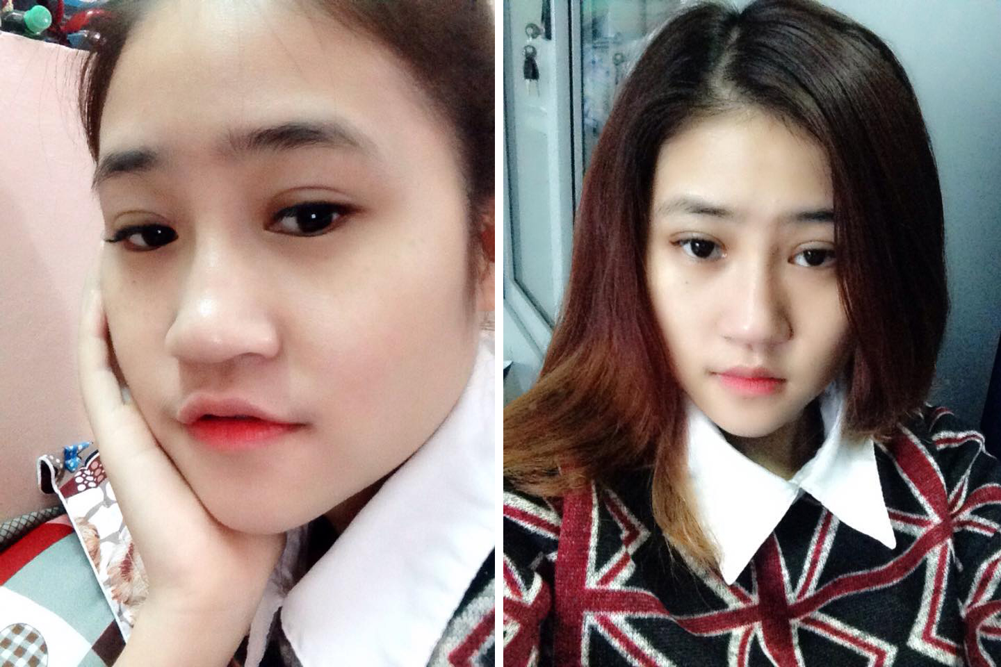 Nhiều khách hàng sở hữu mắt 2 mí đều đẹp nhờ thẩm mỹ mắt tại Kangnam 18