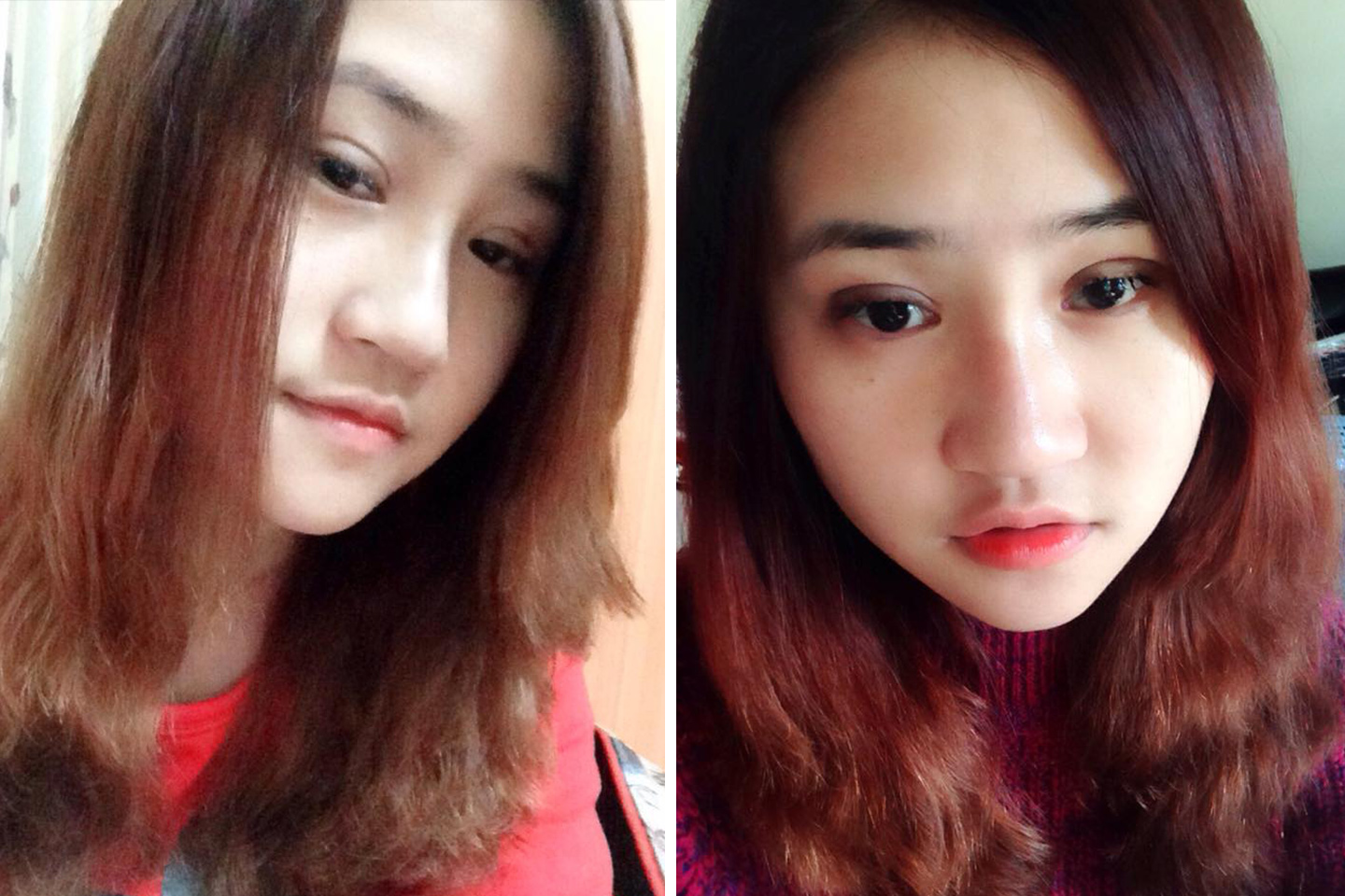 Nhiều khách hàng sở hữu mắt 2 mí đều đẹp nhờ thẩm mỹ mắt tại Kangnam 18