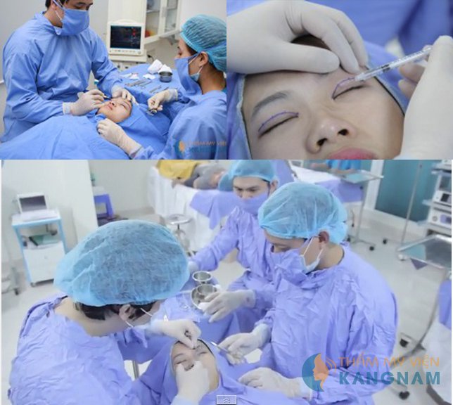 Mắt 2 mí to tròn đã không còn là giấc mơ với Tô Tuyết Trâm7 Mắt 2 mí to tròn đã không còn là giấc mơ với Tô Tuyết Trâm 6