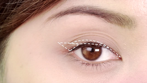 Làm sao chỉnh sửa mắt nhiều mí hiệu quả? 1