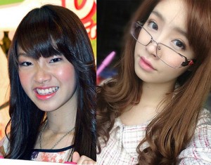 Bấm mí mắt bao lâu thì đẹp?