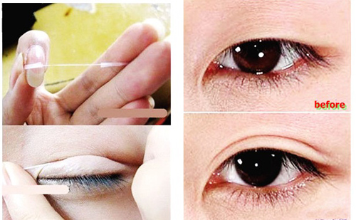 Chỉ kích mí là cách làm mắt to hơn đơn giản được nhiều chị em sử dụng Tuyệt chiêu làm mắt to 2 mí đẹp tự nhiên bằng chỉ kích mí