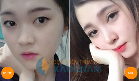 Kangnam chính thức là thành viên Hiệp hội thẩm mỹ Hàn Quốc7889