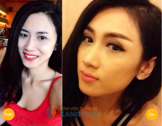 Kangnam chính thức là thành viên Hiệp hội thẩm mỹ Hàn Quốc567