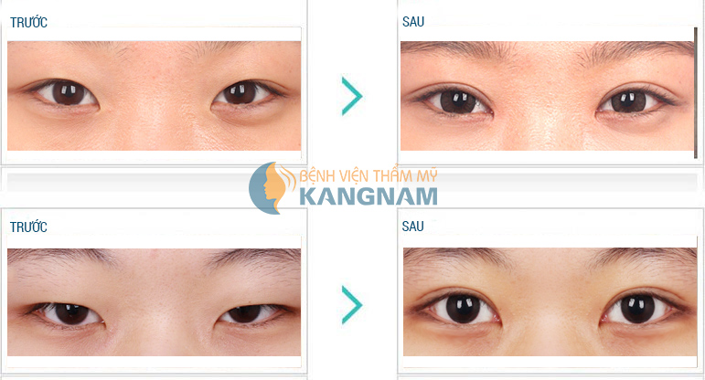 Kangnam chính thức là thành viên Hiệp hội thẩm mỹ Hàn Quốc78