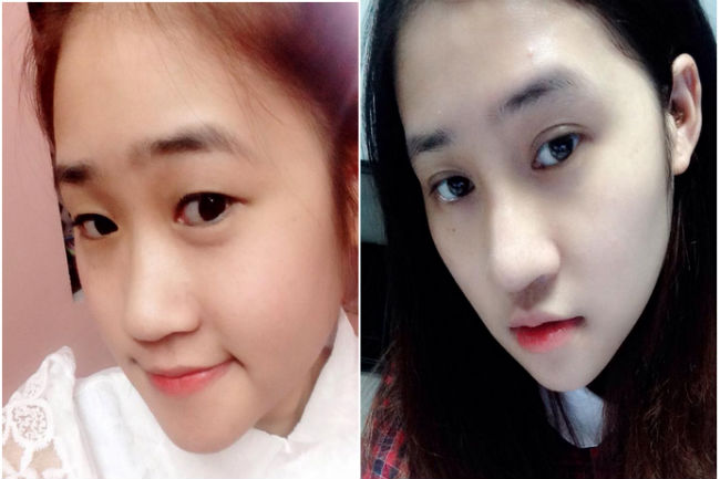 mắt đẹp 2 mí 5343