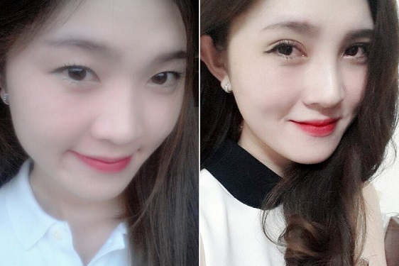 Chua-mat-to-mat-nho11