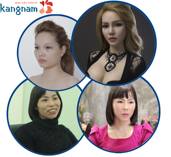 dau-xuan-cam-nhan-khong-khi-lam-dep-nhon-nhip-cua-khach-hang-tai-bvtm-kangnam copy