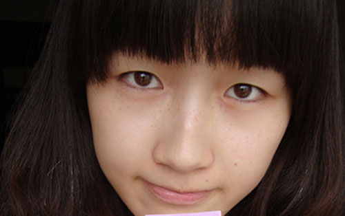 Bấm mí khác cắt mí2