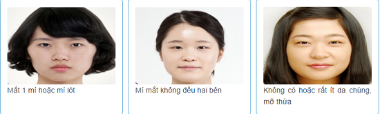 Bạn có phù hợp với bấm mí Hàn Quốc Dove Eyes không?