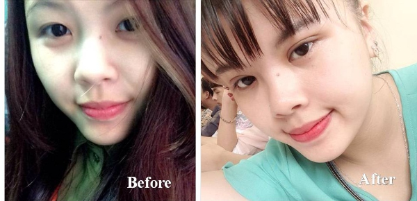 Chinh-sua-mat-to-mat-nho1