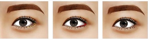 Tạo (cắt) khóe mắt 8