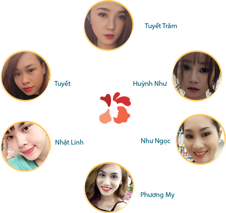 Bấm mí Dove Eyes Hàn Quốc trọn đời sở hữu mắt bồ câu 7