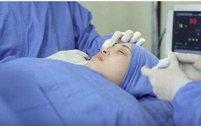 Nâng chân mày có phun xăm chỉ định trong trường hợp nào?