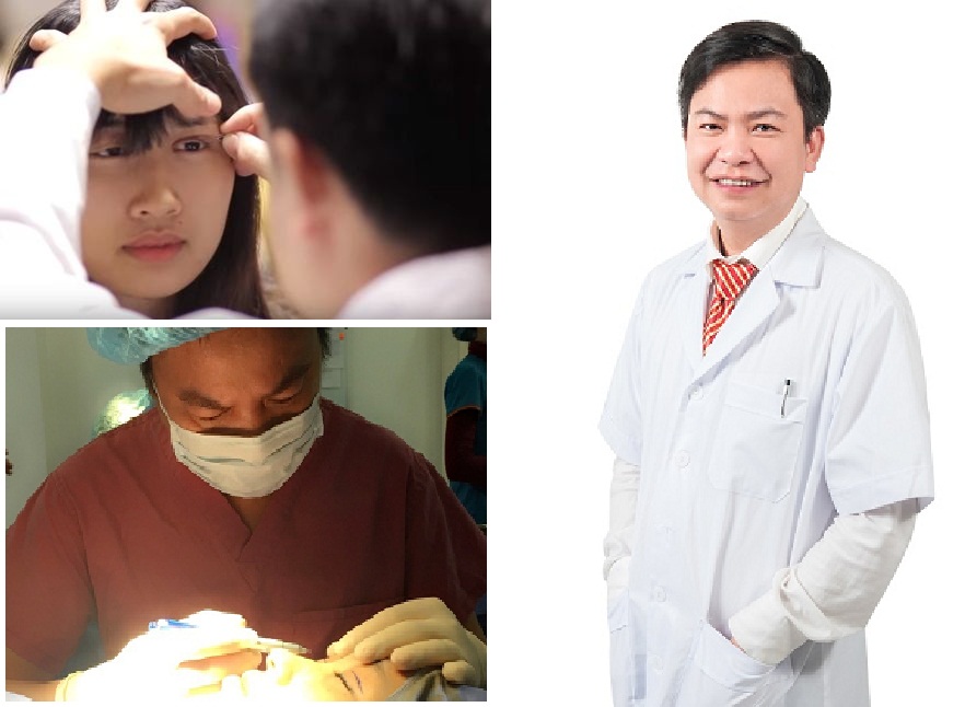 Khắc phục mắt nhiều mí 4