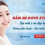 Bấm mí mắt Hàn Quốc Dove Eyes – Mắt to tròn – Đẹp trọn đời