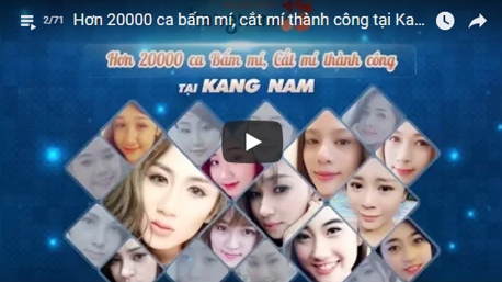 Hơn 20000 ca cắt mí và bấm mí thành công tại Kangnam