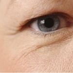 Phải làm sao để khắc phục da chùng, mỡ thừa mí mắt?