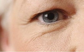 Phải làm sao để khắc phục da chùng, mỡ thừa mí mắt?