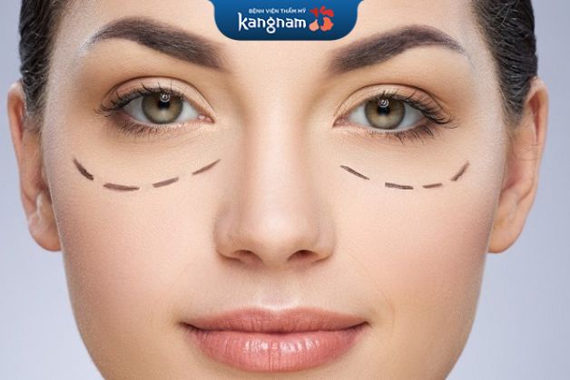 Bổ sung dưỡng chất cho cơ thể thông qua các loại quả tươi, rau xanh,... trước khi cắt mí