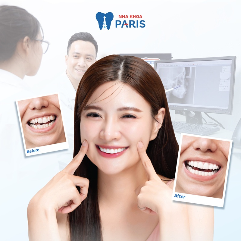 Review nha khoa uy tín: Danh sách 12 địa chỉ đáng tin cậy trên toàn quốc