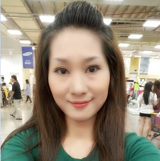 Cắt mí mắt bao lâu thì hết sưng66