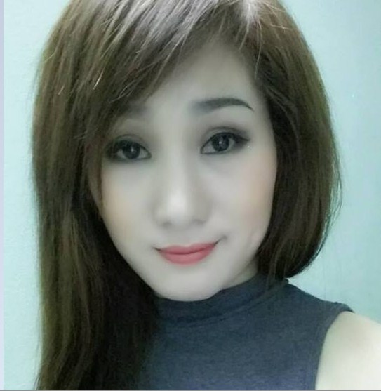 Cắt mí mắt bao lâu thì hết sưng22