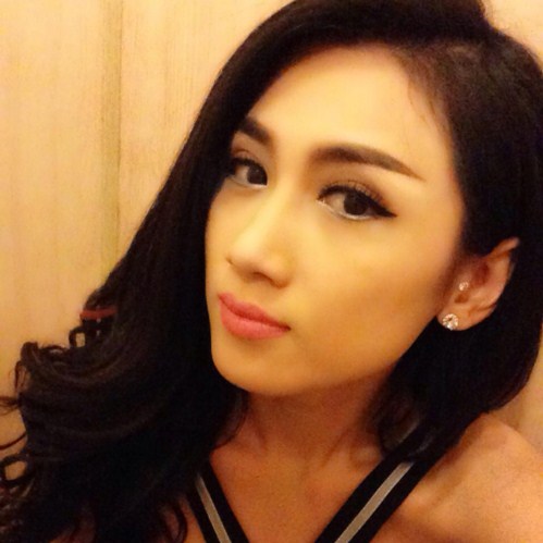 Cắt mí mắt bao lâu thì hết sưng9